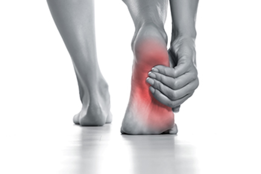 Causes of Foot Arch Pain