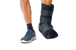 mis bunion