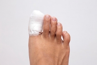 Can I Workout With a Broken Toe?