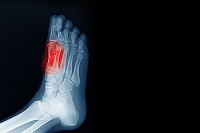 The Function of the Sesamoid Bones in the Feet