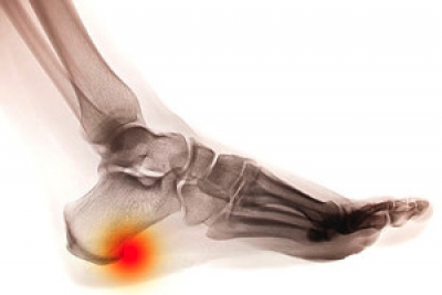 Spur discount under heel