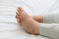 Common Reasons Why Feet Can Swell